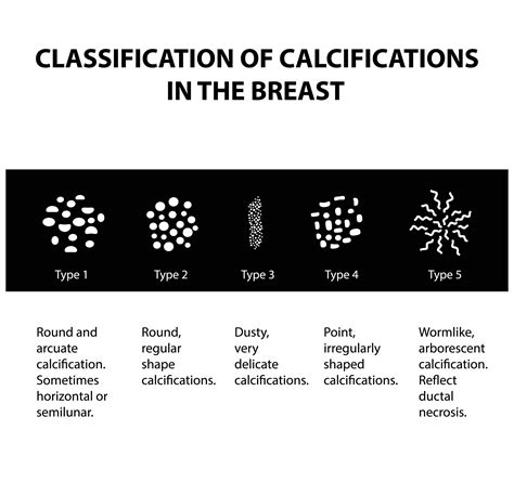 Treatment options may include:<b> Monitoring the tissue for any concerning changes. . How to reduce breast calcifications
